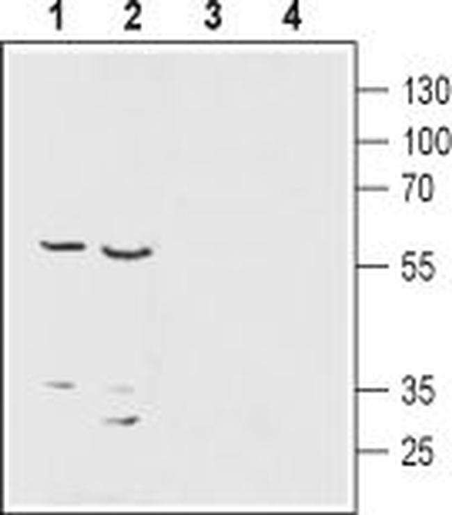 ENT1 (SLC29A1) Antibody in Western Blot (WB)