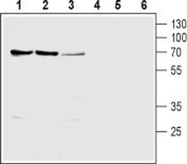 SLC28A1 (CNT1) Antibody in Western Blot (WB)