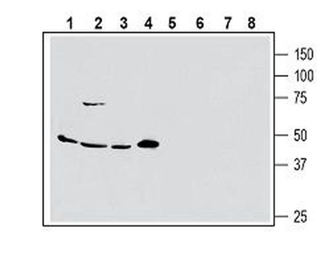 ASCT2/SLC1A5 (extracellular) Antibody in Western Blot (WB)