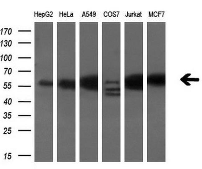 ANXA11 Antibody in Western Blot (WB)