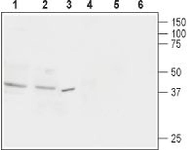 Nociceptin Receptor (OPRL1) Antibody in Western Blot (WB)