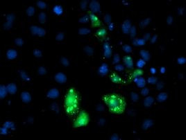 AP2M1 Antibody in Immunocytochemistry (ICC/IF)