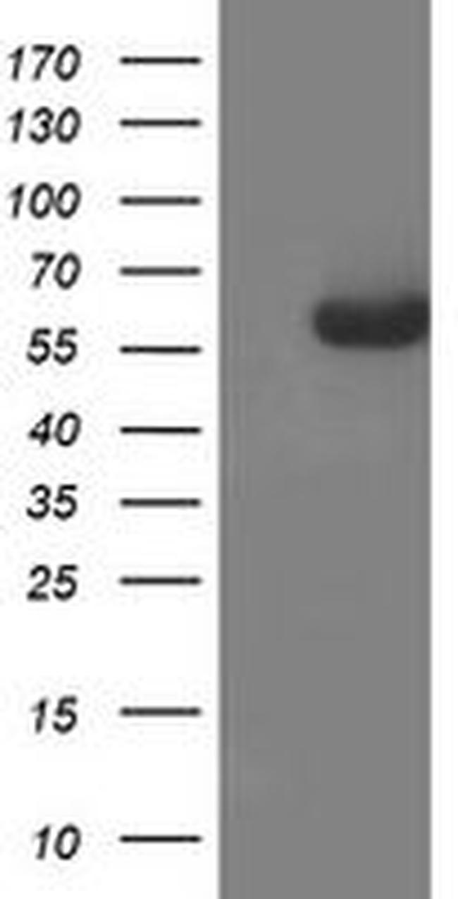 AP2M1 Antibody in Western Blot (WB)