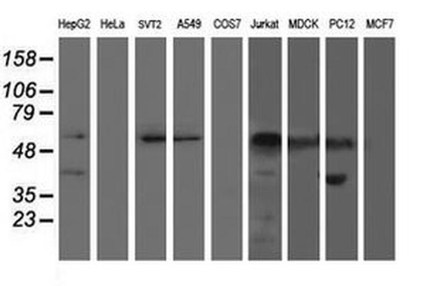 AP2M1 Antibody in Western Blot (WB)