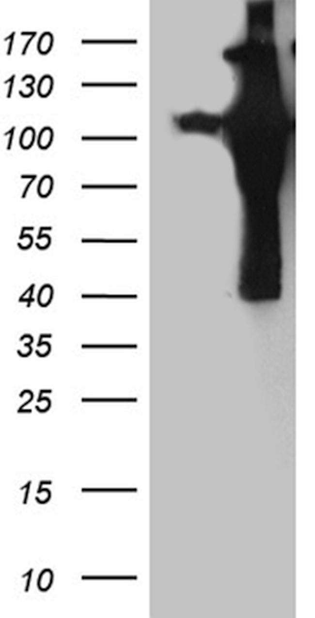 APBB1 Antibody in Western Blot (WB)