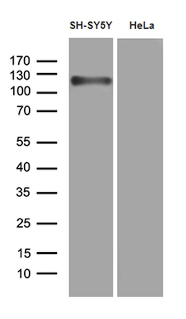 APBB1 Antibody in Western Blot (WB)