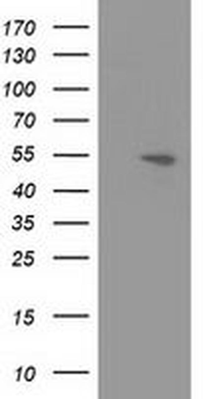 APBB3 Antibody in Western Blot (WB)