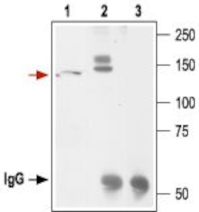 KCNH2 (erg1) Antibody in Immunoprecipitation (IP)