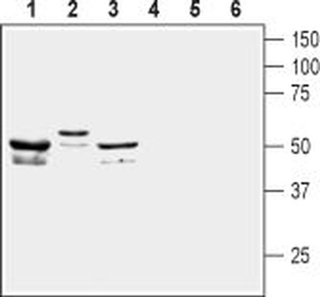 KCNF1 (KV5.1) Antibody in Western Blot (WB)