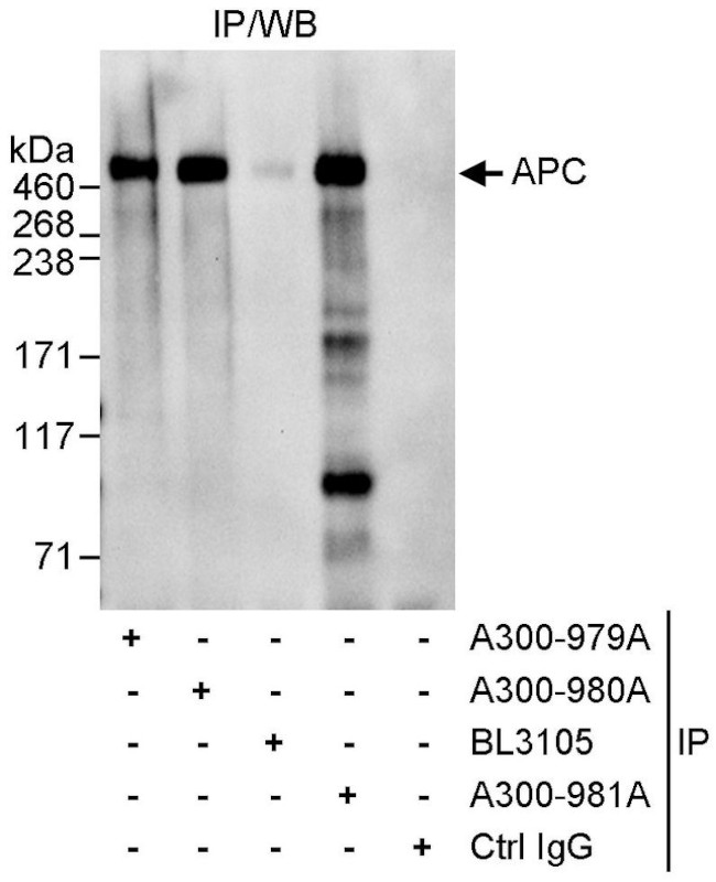 APC Antibody in Immunoprecipitation (IP)