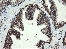 APEX1 Antibody in Immunohistochemistry (Paraffin) (IHC (P))