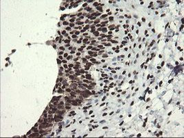 APEX1 Antibody in Immunohistochemistry (Paraffin) (IHC (P))