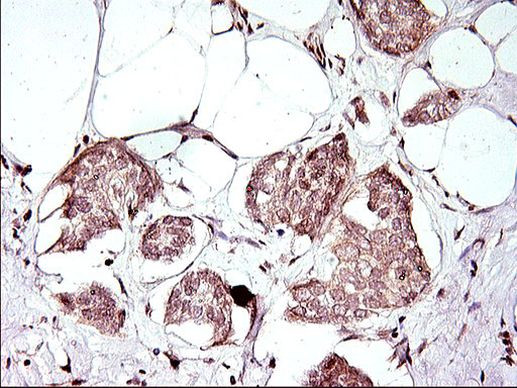 APOA5 Antibody in Immunohistochemistry (Paraffin) (IHC (P))