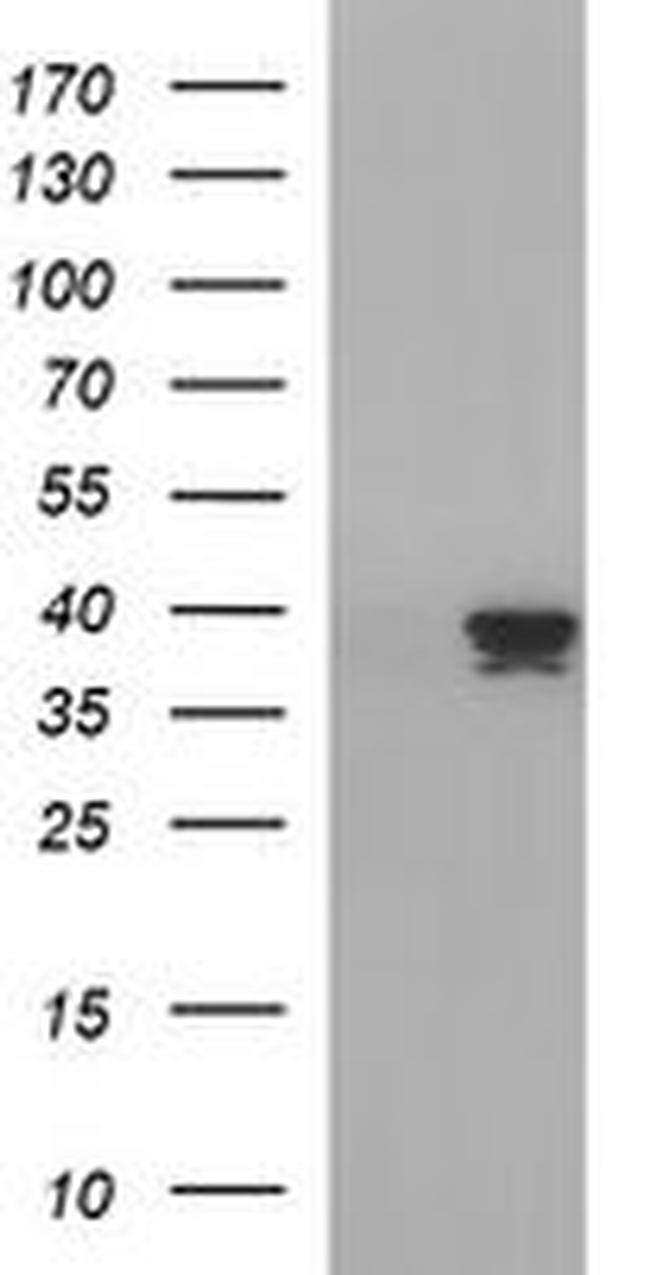 APOA5 Antibody in Western Blot (WB)