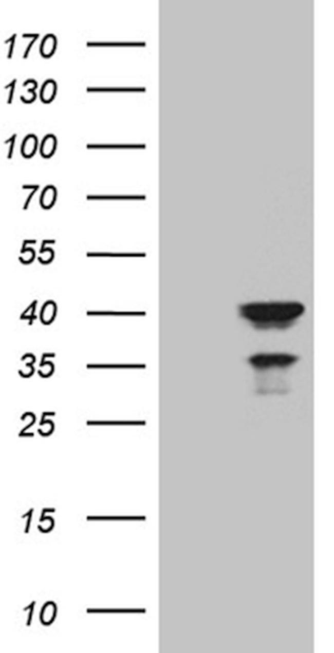 APOL1 Antibody in Western Blot (WB)