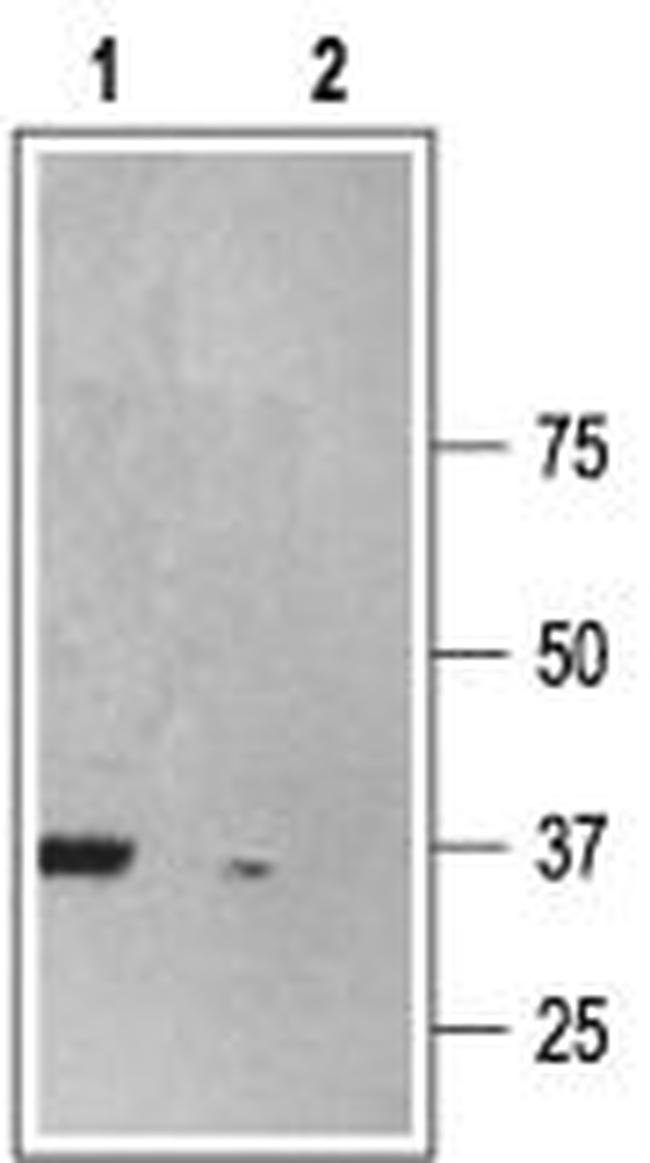 P2X6 Receptor Antibody in Western Blot (WB)
