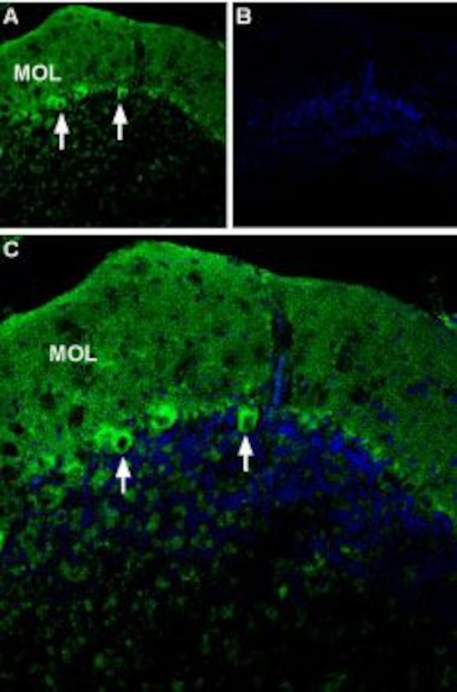 P2X1 Receptor (extracellular) Antibody in Immunohistochemistry (IHC)