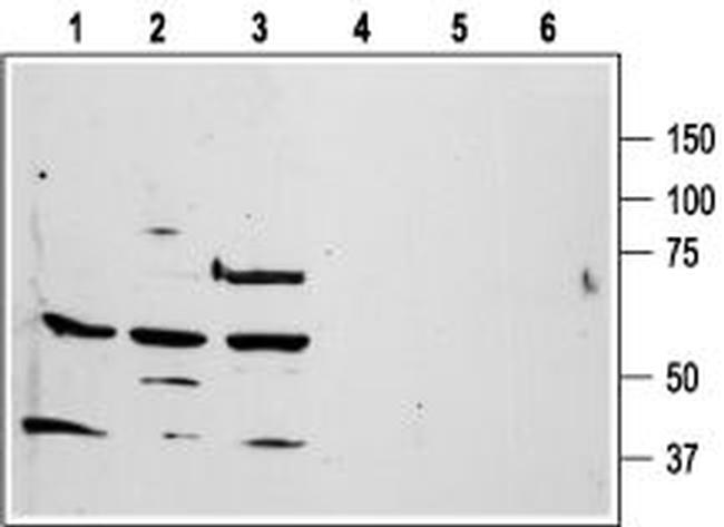 PAR1 (F2R) (extracellular) Antibody in Western Blot (WB)