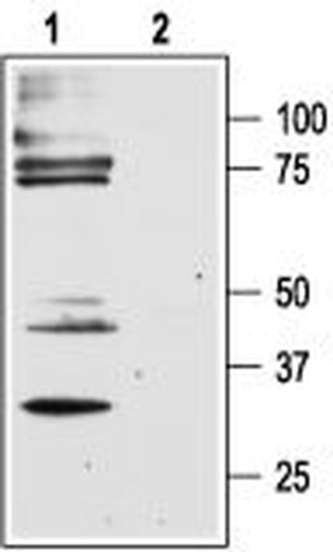 PAR2 (F2RL1) Antibody in Western Blot (WB)