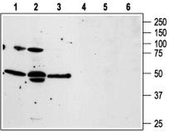 PAR4 (F2RL3) (extracellular) Antibody in Western Blot (WB)