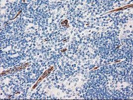 AQP1 Antibody in Immunohistochemistry (Paraffin) (IHC (P))