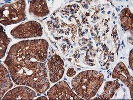 AQP1 Antibody in Immunohistochemistry (Paraffin) (IHC (P))