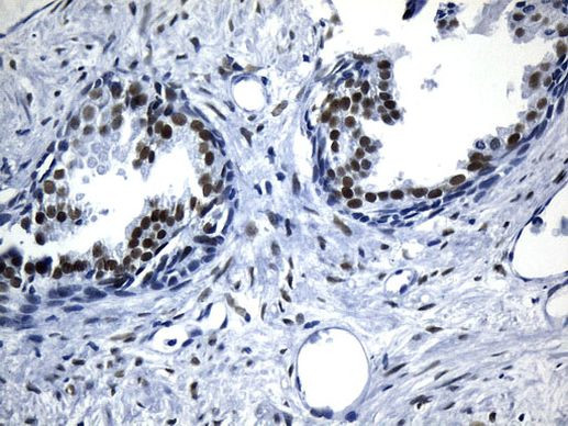 AR Antibody in Immunohistochemistry (Paraffin) (IHC (P))