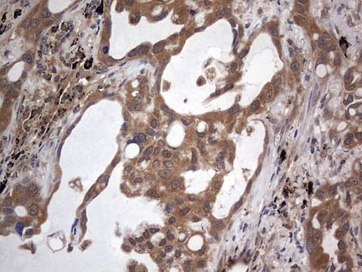 ARAF Antibody in Immunohistochemistry (Paraffin) (IHC (P))