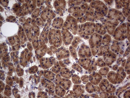 ARAF Antibody in Immunohistochemistry (Paraffin) (IHC (P))