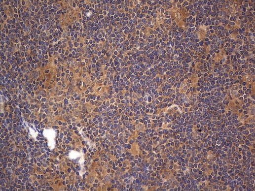 ARAF Antibody in Immunohistochemistry (Paraffin) (IHC (P))