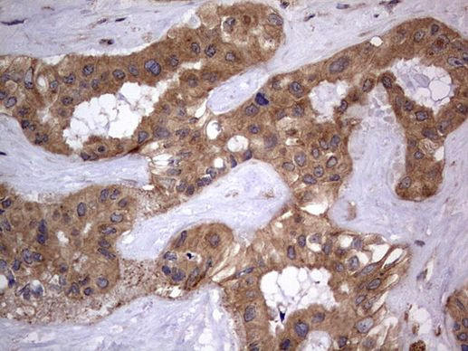 ARAF Antibody in Immunohistochemistry (Paraffin) (IHC (P))