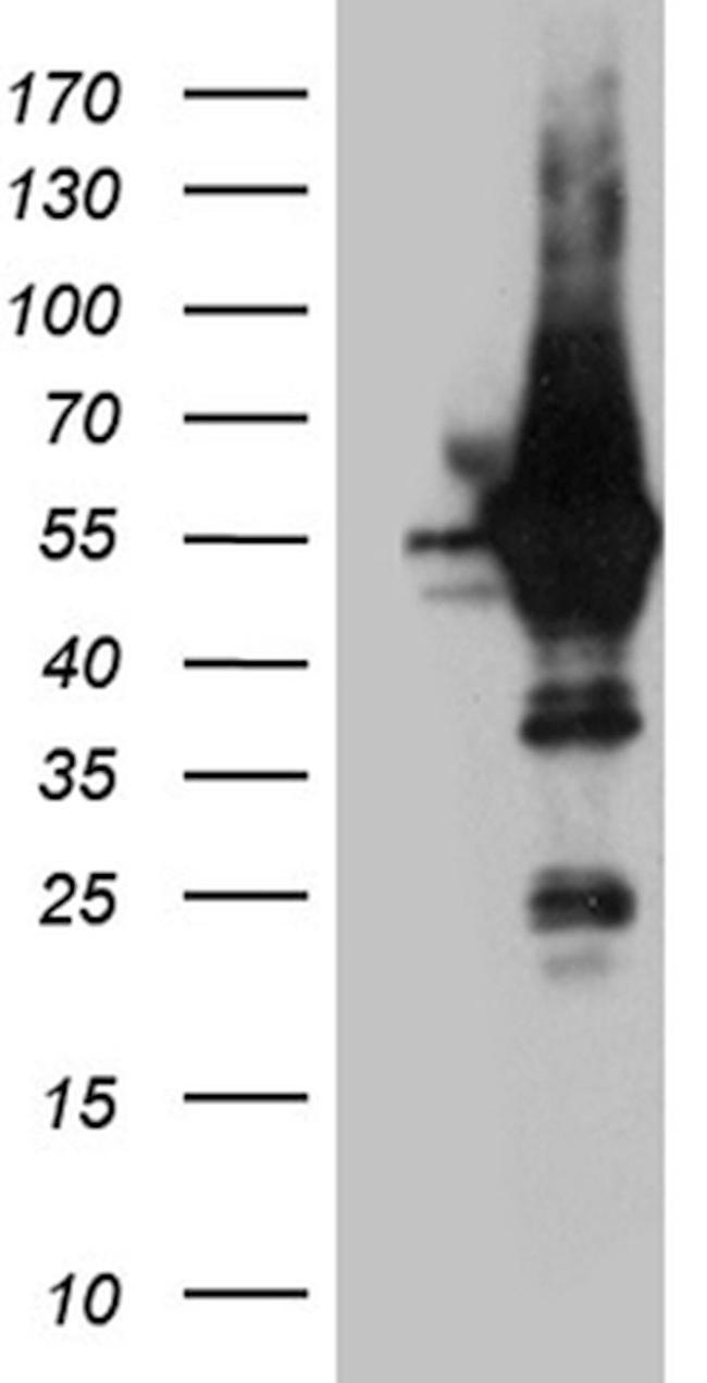 ARC Antibody in Western Blot (WB)