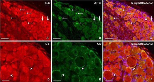 IL-6 Antibody in Immunohistochemistry (IHC)