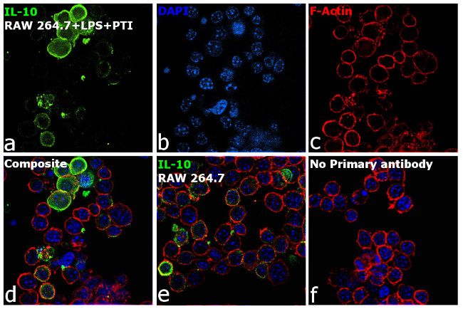 IL-10 Antibody in Immunocytochemistry (ICC/IF)