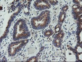 ARCN1 Antibody in Immunohistochemistry (Paraffin) (IHC (P))