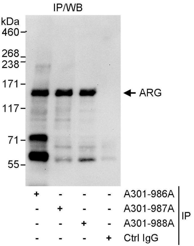 ARG Antibody in Immunoprecipitation (IP)