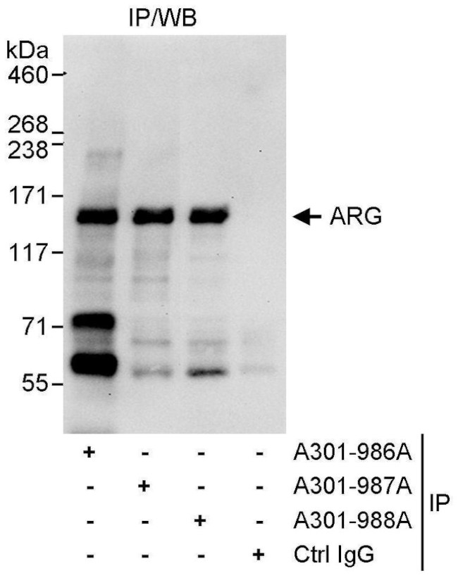 ARG Antibody in Immunoprecipitation (IP)