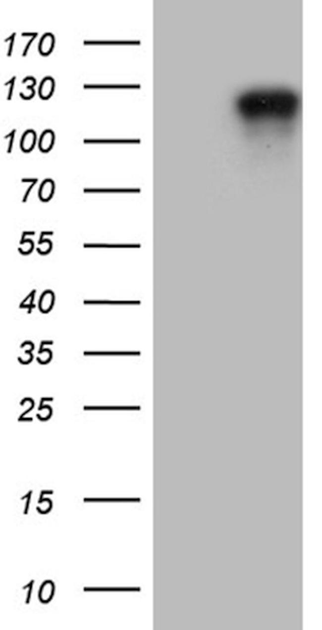 ARHGAP12 Antibody in Western Blot (WB)