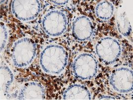 ARHGAP25 Antibody in Immunohistochemistry (Paraffin) (IHC (P))