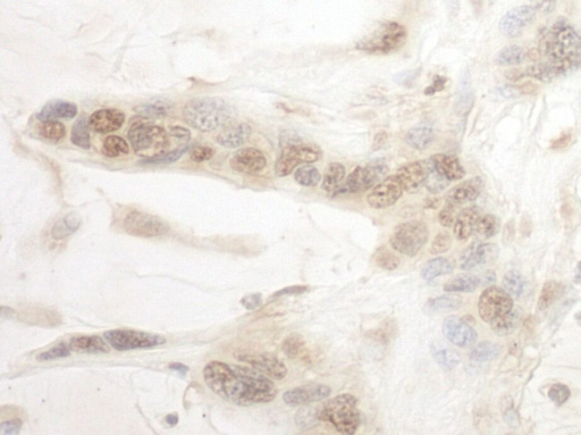 ARID3B Antibody in Immunohistochemistry (IHC)