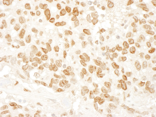 ARID4B Antibody in Immunohistochemistry (IHC)