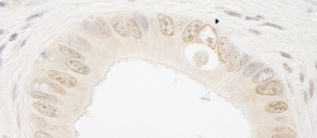 ARIP4 Antibody in Immunohistochemistry (IHC)