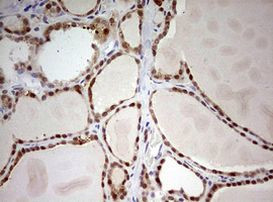 ARL3 Antibody in Immunohistochemistry (Paraffin) (IHC (P))