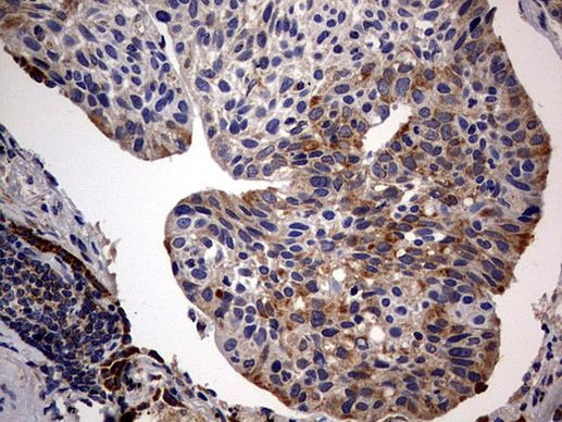 ARL3 Antibody in Immunohistochemistry (Paraffin) (IHC (P))