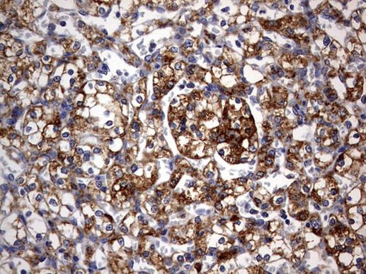 ARL3 Antibody in Immunohistochemistry (Paraffin) (IHC (P))