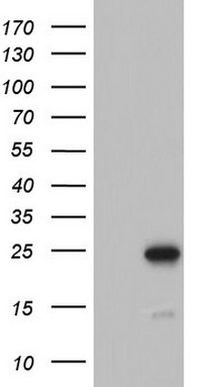 ARL3 Antibody in Western Blot (WB)