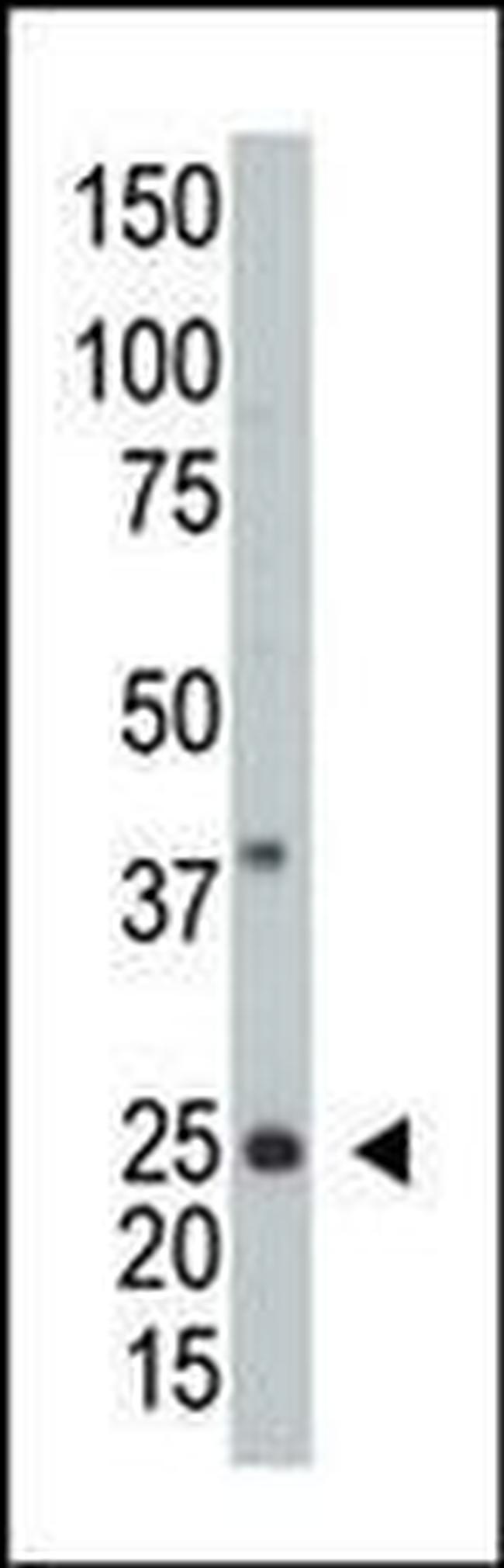 ARL3 Antibody in Western Blot (WB)