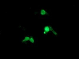 ARL5B Antibody in Immunocytochemistry (ICC/IF)