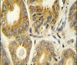 ARL8A Antibody in Immunohistochemistry (IHC)