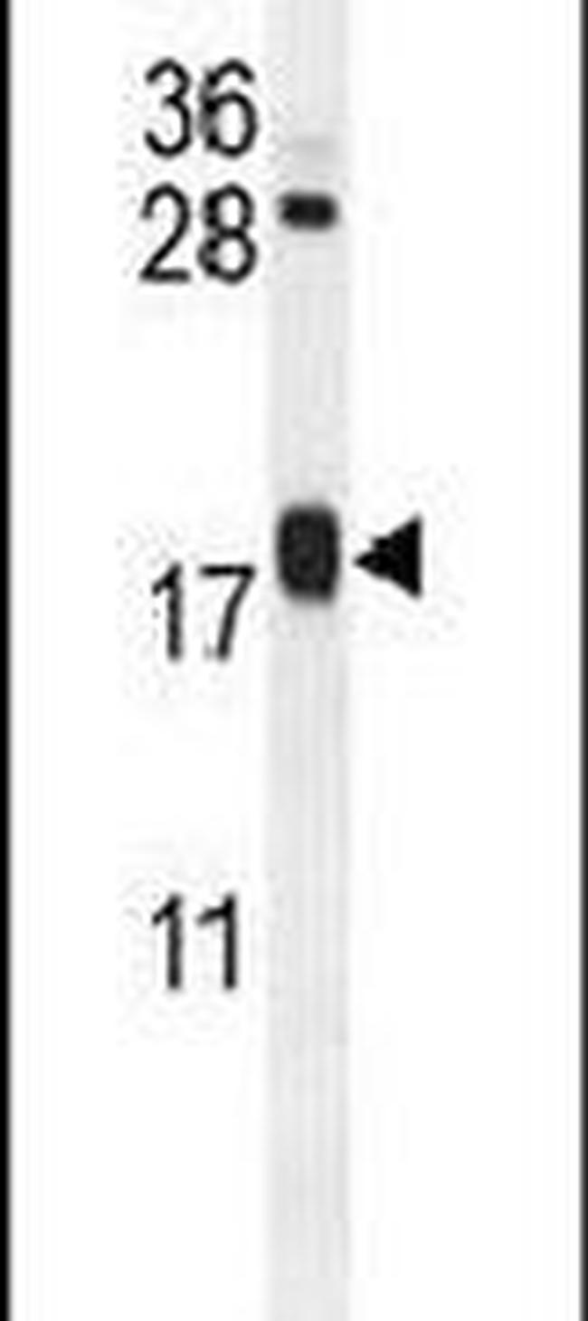 ARL8A Antibody in Western Blot (WB)